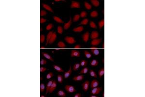 Immunofluorescence analysis of U2OS cell using CD3E antibody. (CD3 epsilon anticorps  (AA 25-207))