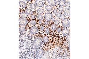 Immunohistochemical analysis of paraffin-embedded Human colon tissue using C performed on the Leica® BOND RXm. (Haptoglobin anticorps  (Center))