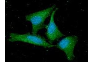 ICC/IF analysis of GMFB in HeLa cells line, stained with DAPI (Blue) for nucleus staining and monoclonal anti-human GMFB antibody (1:100) with goat anti-mouse IgG-Alexa fluor 488 conjugate (Green).