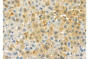 ABIN6261280 and ABIN6279617 at 1/100 staining Rat liver tissue by IHC-P. (Non-Syndromic Hearing Impairment Protein 5 (GSDME) (C-Term) anticorps)