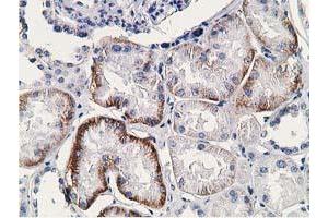 Image no. 7 for anti-Synovial Sarcoma, X Breakpoint 1 (SSX1) antibody (ABIN1501156) (SSX1 anticorps)