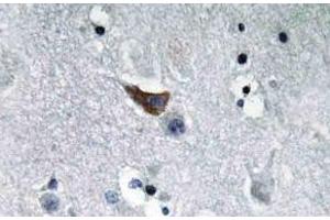 Immunohistochemistry (IHC) analyzes of GluR1 antibody in paraffin-embedded human brain tissue. (Glutamate Receptor 1 anticorps)