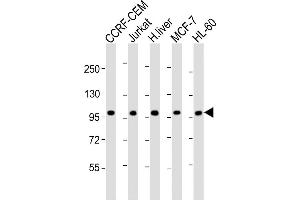 All lanes : Anti-RSBN1 Antibody (N-term) at 1:2000 dilution Lane 1: CCRF-CEM whole cell lysate Lane 2: Jurkat whole cell lysate Lane 3: human liver lysate Lane 4: MCF-7 whole cell lysate Lane 5: HL-60 whole cell lysate Lysates/proteins at 20 μg per lane. (RSBN1 anticorps  (N-Term))