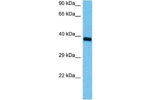 Host:  Mouse  Target Name:  HSD17B1  Sample Tissue:  Mouse Heart  Antibody Dilution:  1ug/ml (HSD17B1 anticorps  (N-Term))