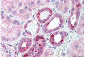 Human Kidney (formalin-fixed, paraffin-embedded) stained with SERTAD1 antibody ABIN214142 at 5 ug/ml followed by biotinylated goat anti-rabbit IgG secondary antibody ABIN481713, alkaline phosphatase-streptavidin and chromogen. (SERTAD1 anticorps  (N-Term))