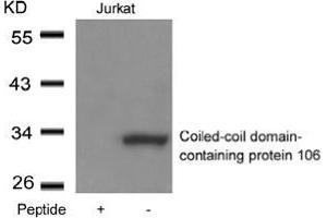 Western blot analysis of extracts from Jurkat cells using Coiled-coil domain-containing protein 106and the same antibody preincubated with blocking peptide. (CCDC106 anticorps  (Coiled coil domain))