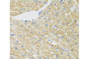 Immunohistochemistry of paraffin-embedded Mouse heart using INPP5J Polyclonal Antibody at dilution of 1:100 (40x lens). (INPP5J anticorps)
