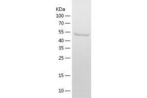 Western Blotting (WB) image for Follistatin (FST) (AA 30-317) protein (His-IF2DI Tag) (ABIN7122987)