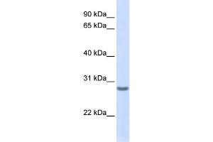 WB Suggested Anti-TSPAN6 Antibody Titration:  0. (Tetraspanin 6 anticorps  (N-Term))