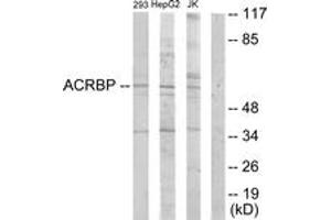 Western blot analysis of extracts from HepG2/Jurkat/293 cells, using ACRBP Antibody. (ACRBP anticorps  (AA 181-230))