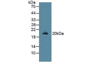 Figure. (RSPO1 anticorps  (AA 136-262))