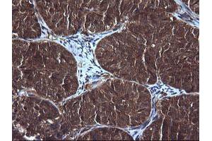 Image no. 4 for anti-DEAD (Asp-Glu-Ala-Asp) Box Polypeptide 58 (DDX58) antibody (ABIN1500708) (DDX58 anticorps)