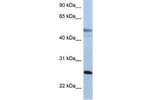 WB Suggested Anti-KRT8  Antibody Titration: 0.