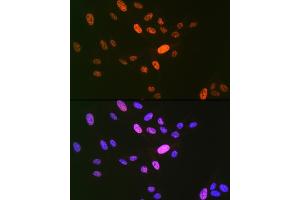 Immunofluorescence analysis of U-2 OS cells using DNA Ligase I Rabbit mAb (ABIN7268251) at dilution of 1:100 (40x lens).