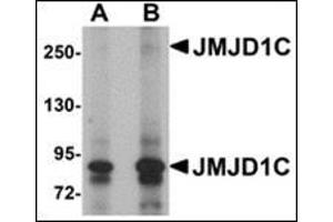 Western blot analysis of JMJD1C in human liver tissue lysate with this product at (A) 1 and (B) 2 μg/ml. (JMJD1C anticorps  (N-Term))