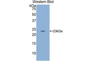 Western blot analysis of the recombinant protein. (CD8B anticorps  (AA 21-208))