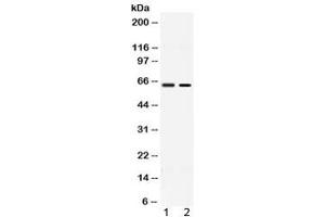 Western blot testing of 1) rat testis and 2) human MCF7 lysate with ACCN1 antibody at 0. (ACCN1 anticorps  (AA 112-147))