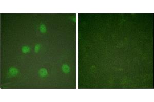 Immunofluorescence analysis of HeLa cells, treated with A (125 ng/mL, 30 mins), using Cullin 1 antibody.