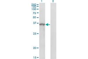 Western Blot analysis of SPRY1 expression in transfected 293T cell line by SPRY1 monoclonal antibody (M01), clone 3H4.