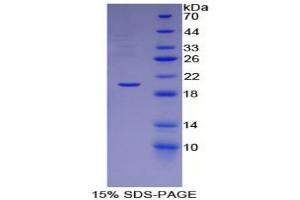 SDS-PAGE analysis of Rat ESM1 Protein. (ESM1 Protéine)