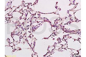 Formalin-fixed and rat lung tissue labeled with Anti-B7-H1/PD-L1/CD274 Polyclonal Antibody, Unconjugated (ABIN737706) at 1:200 followed by conjugation to the secondary antibody and DAB staining