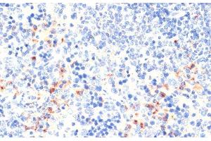 Immunohistochemistry of paraffin-embedded Mouse spleen using CD68 Polyclonal Antibody at dilution of 1:100 (40x lens). (CD68 anticorps)