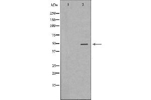 Western blot analysis of extracts from Hela  using KRT20 Antibody. (KRT20 anticorps  (C-Term))