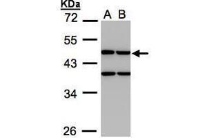 WB Image Sample(30 ug whole cell lysate) A:H1299 B:HeLa S3, 10% SDS PAGE antibody diluted at 1:1000 (CKMT1B anticorps)