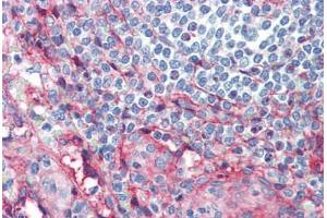Human Spleen (formalin-fixed, paraffin-embedded) stained with ICAM1 antibody ABIN462119 followed by biotinylated anti-mouse IgG secondary antibody ABIN481714, alkaline phosphatase-streptavidin and chromogen. (ICAM1 anticorps)