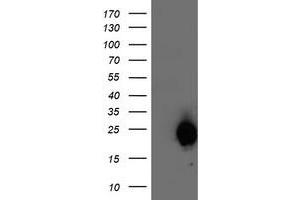 Western Blotting (WB) image for anti-ADP-Ribosylation Factor-Like 11 (ARL11) antibody (ABIN1496714) (ARL11 anticorps)