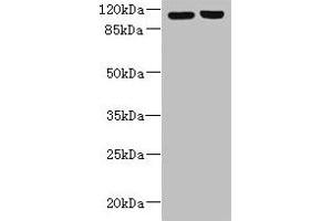 Western blot All lanes: RPGR antibody at 6 μg/mL Lane 1: 293T whole cell lysate Lane 2: Hela whole cell lysate Secondary Goat polyclonal to rabbit IgG at 1/10000 dilution Predicted band size: 114, 91, 71, 84, 53, 128 kDa Observed band size: 114 kDa
