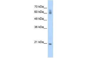 FIP1L1 antibody used at 0. (FIP1L1 anticorps)