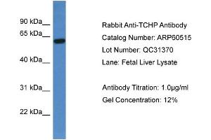 WB Suggested Anti-TCHP  Antibody Titration: 0.