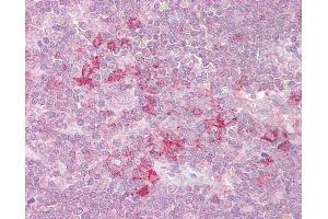 Anti-MST4 antibody IHC of human thymus.