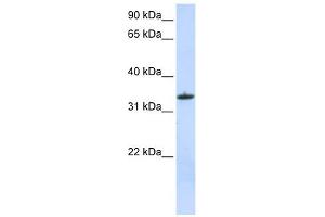 MRPL15 antibody used at 1 ug/ml to detect target protein.