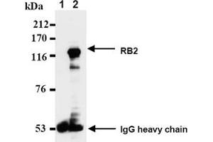 Western Blotting (WB) image for anti-Retinoblastoma-Like 2 (p130) (RBL2) antibody (ABIN487489) (p130 anticorps)