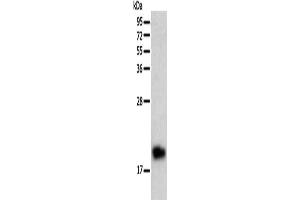 Gel: 12 % SDS-PAGE, Lysate: 40 μg, Lane: Human liver cancer tissue, Primary antibody: ABIN7128688(BTG2 Antibody) at dilution 1/200, Secondary antibody: Goat anti rabbit IgG at 1/8000 dilution, Exposure time: 10 minutes (BTG2 anticorps)
