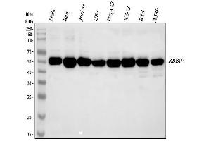Western blot analysis of RbAp48 using anti-RbAp48 antibody (ABIN3043920). (Retinoblastoma Binding Protein 4 anticorps  (C-Term))