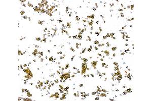 Immunocytochemistry (ICC) image for anti-Tubulin, beta 3 (TUBB3) (AA 400-450) antibody (ABIN7453957) (Recombinant TUBB3 anticorps  (AA 400-450))