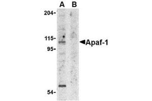 Image no. 2 for anti-Apoptotic Peptidase Activating Factor 1 (APAF1) (AA 12-28) antibody (ABIN319002) (APAF1 anticorps  (AA 12-28))