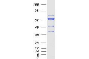 Validation with Western Blot