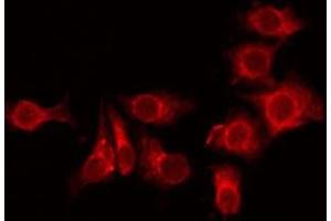 ABIN6275804 staining HuvEc by IF/ICC. (TMEM101 anticorps  (Internal Region))