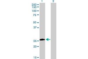 Western Blot analysis of STX8 expression in transfected 293T cell line by STX8 MaxPab polyclonal antibody.