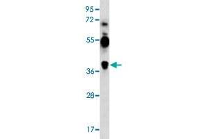 Western blot analysis of K-562 cell lysate (35 ug/lane) with MAGEA12 polyclonal antibody . (MAGEA12 anticorps  (N-Term))