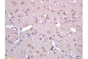 Formalin-fixed and paraffin embedded rat brain labeled with Rabbit Anti SPAG5/MAP126/Astrin Polyclonal Antibody, Unconjugated (ABIN672261) at 1:200 followed by conjugation to the secondary antibody and DAB staining (SPAG5 anticorps  (AA 1101-1193))