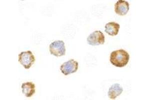 Immunocytochemistry of ASK1 in A431 cells with AP30086PU-N ASK1 antibody at 2 μg/ml.