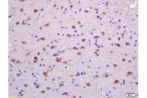 Formalin-fixed and paraffin embedded rat brain labeled with Rabbit Anti phospho-PKC delta (Tyr311) Polyclonal Antibody, Unconjugated (ABIN703270) at 1:200 followed by conjugation to the secondary antibody and DAB staining (PKC delta anticorps  (pTyr313))