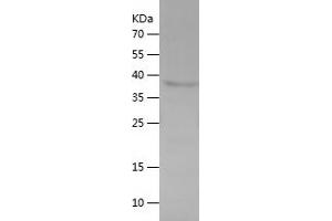 Western Blotting (WB) image for Transforming, Acidic Coiled-Coil Containing Protein 1 (TACC1) (AA 518-805) protein (His tag) (ABIN7125460)