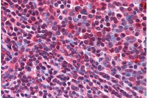 Human Tonsil (formalin-fixed, paraffin-embedded) stained with CD5L antibody ABIN214596 at 5 ug/ml followed by biotinylated goat anti-rabbit IgG secondary antibody ABIN481713, alkaline phosphatase-streptavidin and chromogen. (CD5L anticorps  (N-Term))