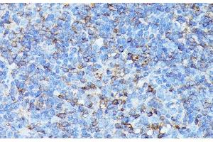 anti-Chemokine (C-X-C Motif) Receptor 1 (CXCR1) antibody